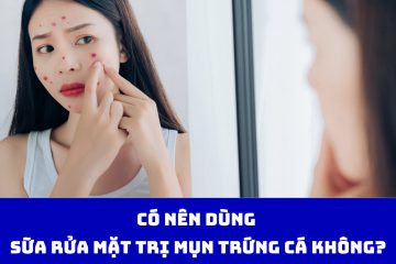 Có nên dùng sữa rửa mặt trị mụn trứng cá hay không?