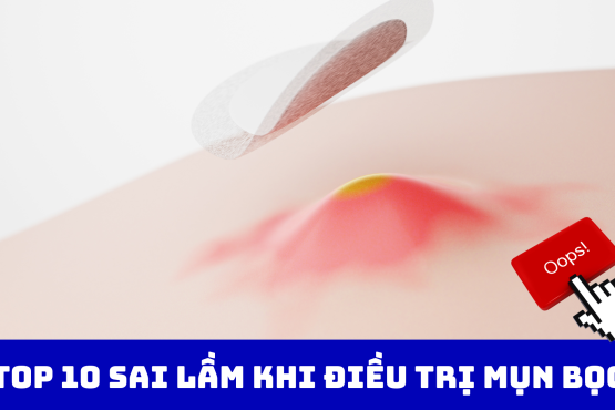 Top 10 Sai Lầm Khi Điều Trị Mụn Bọc